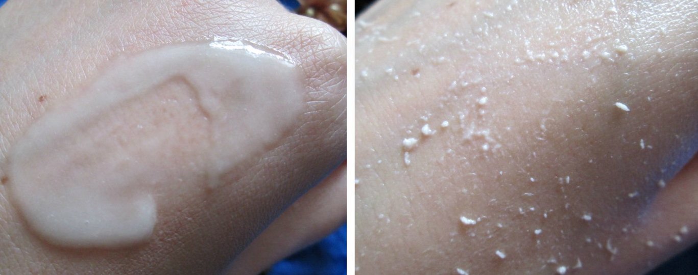 -   Peeling Gel