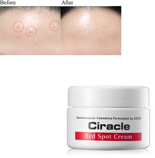     Anti Acne Red Spot Cream Ciracle (,  1)
